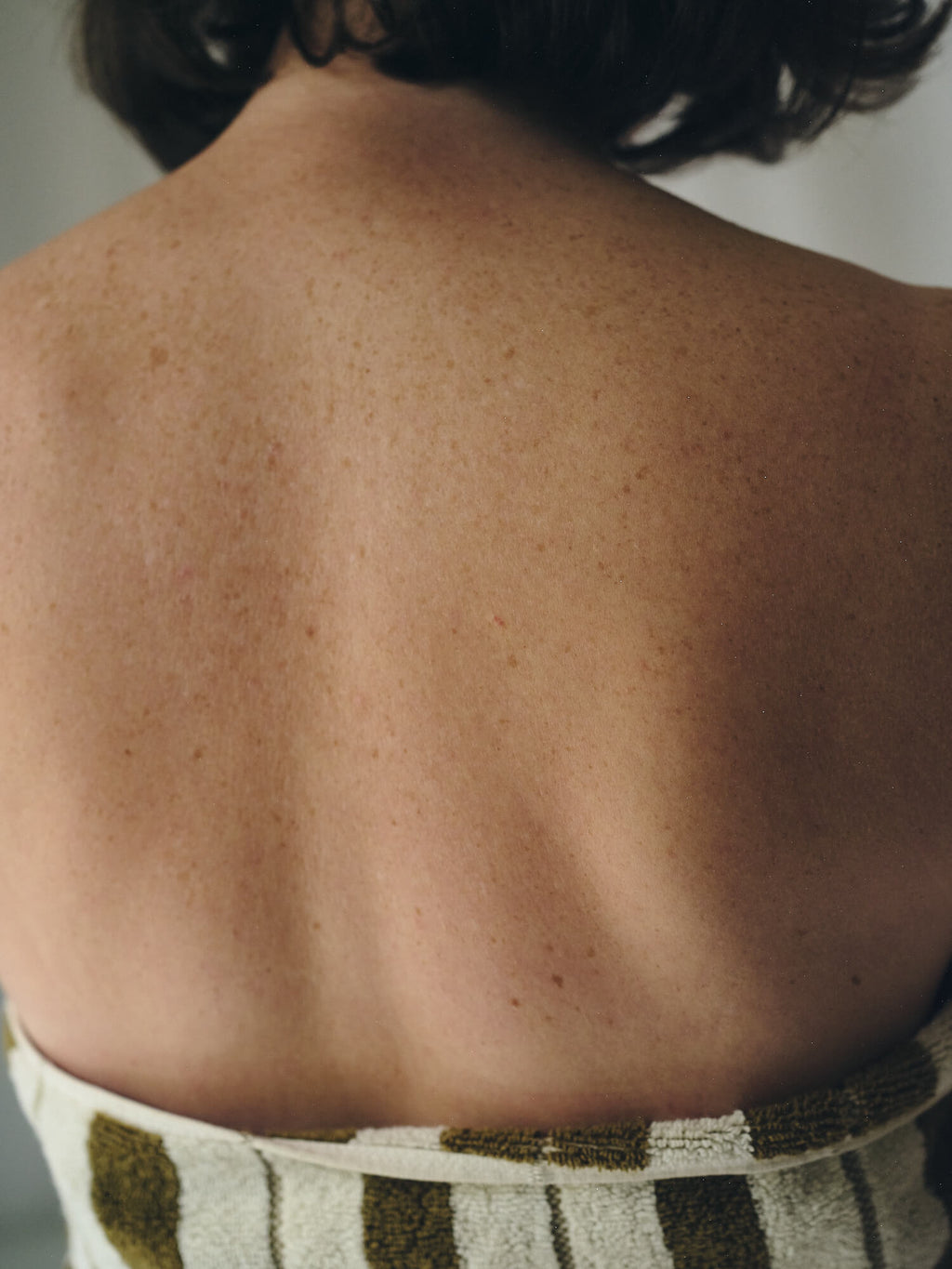 Peau du dos après le lait hydratant MAPIEL
