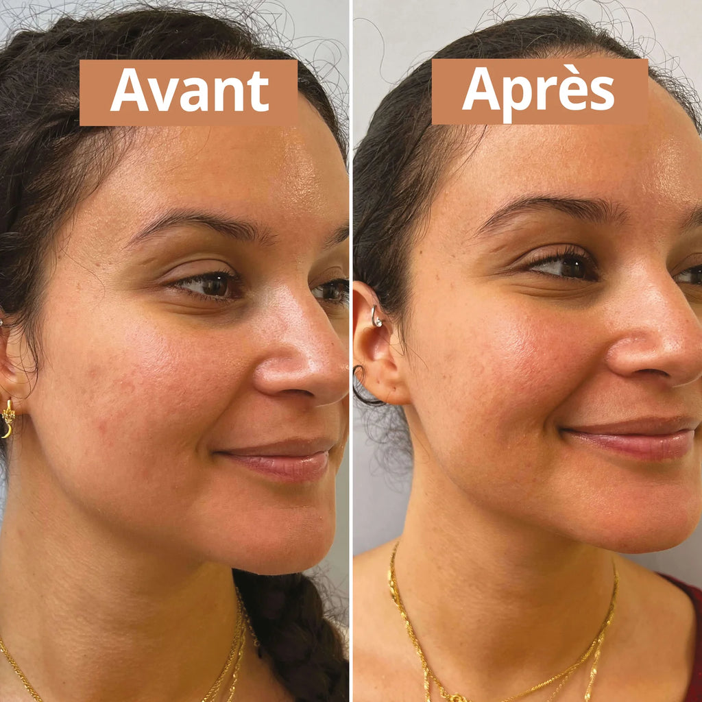 Sérum hydratant visage acide hyaluronique – sans parfum