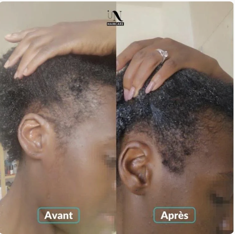 Growth Capsules - Strengthening and Volume